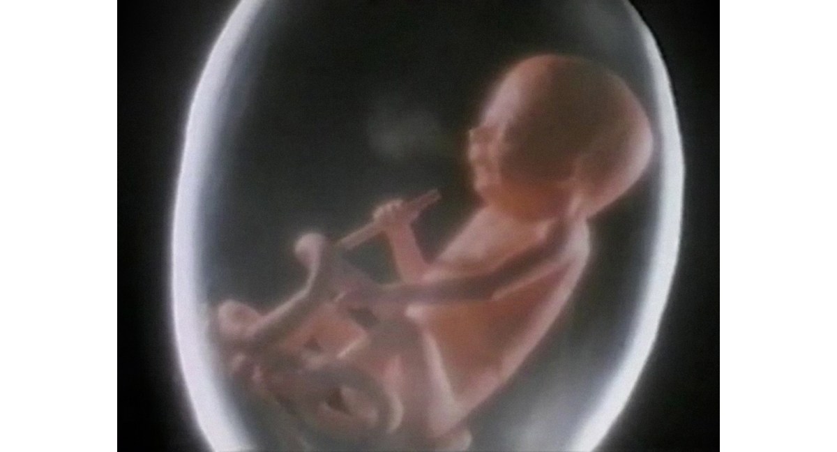 American Cancer Society’s “Smoking&nbsp;Fetus”